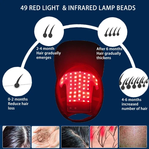 Hair Loss LED Red and Blue Near Infrared Light Therapy Cap Hat for Hair Regrowth - Picture 4 of 12