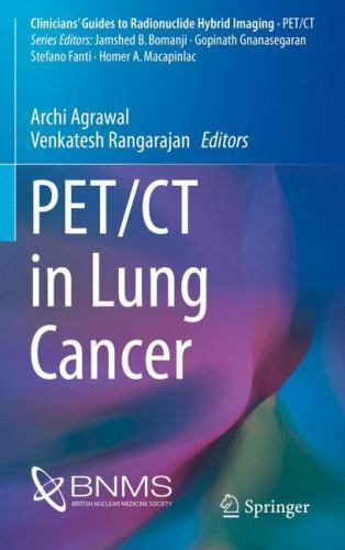 PET/CT in Lung Cancer (Clinicians’ Guides to Radionuclide Hybrid Imaging) - Image 3