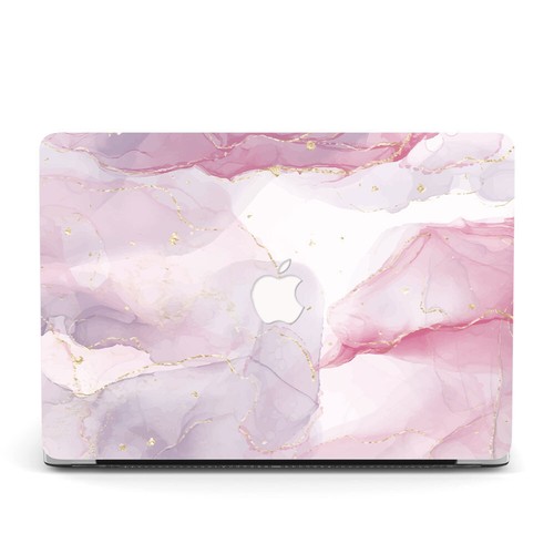 MultiColor Marbled Matte Hard Shell for 2024 MacBook Pro Air 13" 15" A3113 A3114 - Picture 36 of 69