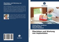 ÜBerleben Und Wartung Von Implantaten Amit Bhardwaj