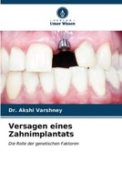 Versagen Eines Zahnimplantats Akshi Varshney
