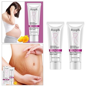 mango stretch mark cream