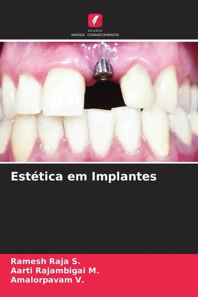 Ramesh Raja S. (U. A.) | EstéTica Em Implantes | Taschenbuch | Portugiesisch-image