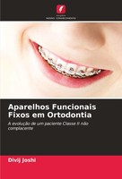Aparelhos Funcionais Fixos Em Ortodontia Divij Joshi
