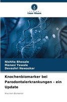 Knochenbiomarker Bei Parodontalerkrankungen - Ein Update | Knochen-Biomarker