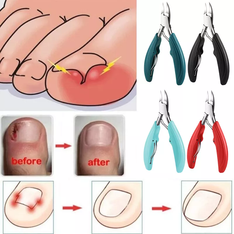 Toenail Clippers for Elderly Used For Thick Toenails Fungi Ingrown Toenails