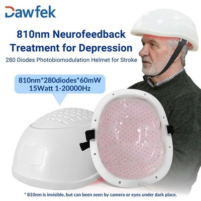 Neuron Stimulation 810nm PBM Helmet Brain Stroke Parkinson Rehabilitation