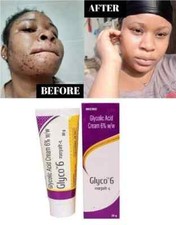 GLYCO 6 GLYCOLIC ACID CREAM 6 30gm BY MICROLABS Exp Jun 2027