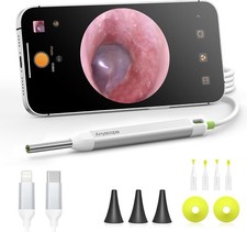 Digital Otoscope with Gyroscope HD Ear Camera Cleaning Wax Pick Cleaner Kit