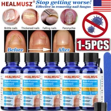 1~5PCS HEALMUSZ Toenail Fungus Treatment for Nail & Fingernails Repair Solution