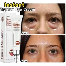 Magic Eye Cream 28 Seconds to Remove Eye Bags / Dark Circles / Eye Wrinkles