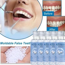 Tooth Repair Granules Temporary Tooth Repair Kit Fitting filling Beads Reusable