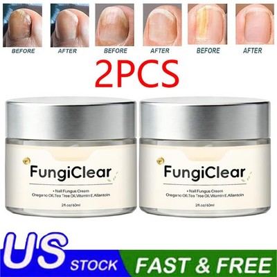 2PCS FungiClear Phrena Nail Care Cream With Tea Tree Oil, Oregano Oil, Vitamin E