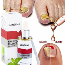 15ml ANTI FUNGAL support EXTRA STRENGTH TOENAIL FUNGUS FUNGI NAIL ATHLETE'S FOOT