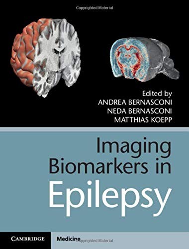 Imaging Biomarkers in Epilepsy by Andrea Bernasconi (Hardcover)