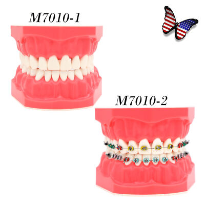 Dental Teach Typodont Demonstration Teeth Model 1:1 For Patient Study with Brace