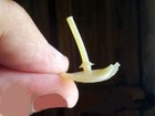Foto 2 di 4