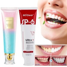 Niacinamide Whitening Toothpaste Probiotic Whitening Toothpaste Teeth Whitening