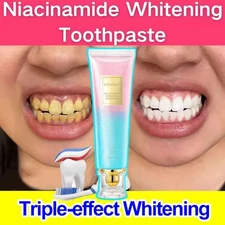 Niacinamide Whitening Toothpaste,100g Niacinamide Intensive Whitening Toothpaste