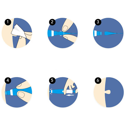 Produktbild von Skin Tag Entferner, Skin Tag Remover Kit 40 Bänder Und 36