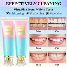2X Niacinamide Whitening Toothpaste,100g Niacinamide Toothpaste,Teeth Whitening