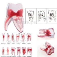 RCT 3D Print Dental Blocks Files Practice Block Endo Training Model Replicas
