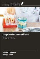 Zalak Thakkar (U. A.) | Implante Inmediato | Taschenbuch | Spanisch (2023)