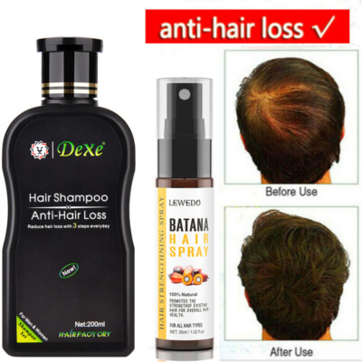 DEXE Hair Growth Shampoo, Anti-Hair Loss Shampoo, Hair Regrowth For Men & Women