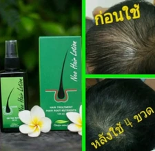 Neo Hair Lotion