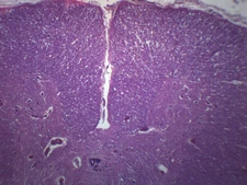 10PK Cervical Spinal Cord, Human - CS - Prepared Slides - 75x25mm - Eisco Labs
