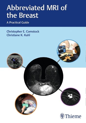 Abbreviated MRI of the Breast – A Practical Guide Comstock Kuhl Hardback