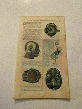 KP134) Human Brain Eye Skull Application To Printing 1856 Engraving