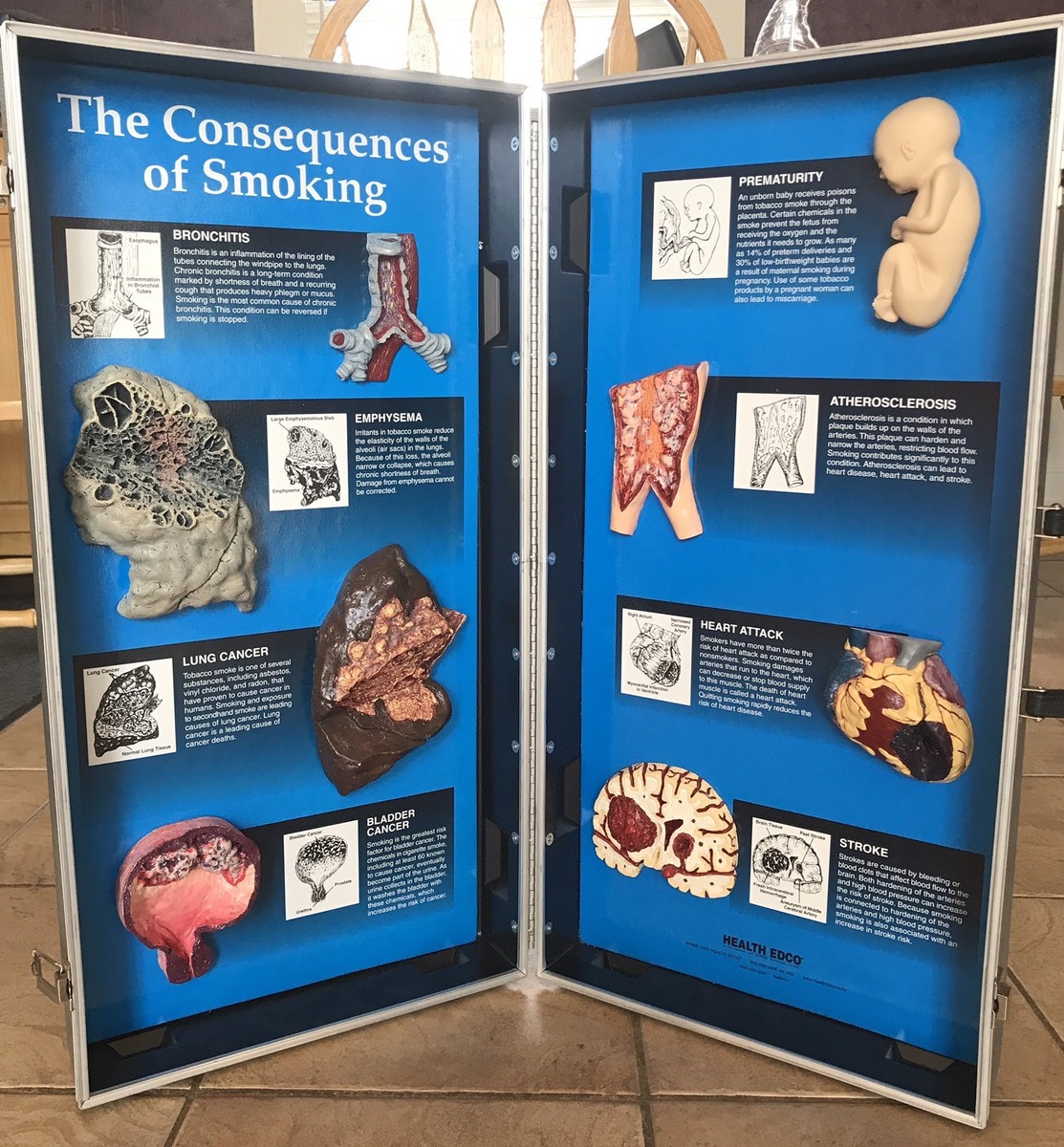 Health Edco the CONSEQUENCES of SMOKING case cigarette EDUCATIONAL birth,  heart