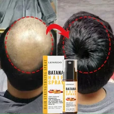 Batana Oil For Unisex Hair Growth Spray Anti-Hair Loss Damaged Hair Root Repair