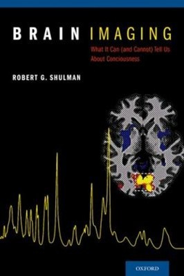 Brain Imaging : What It Can and Cannot Tell Us about Consciousnes