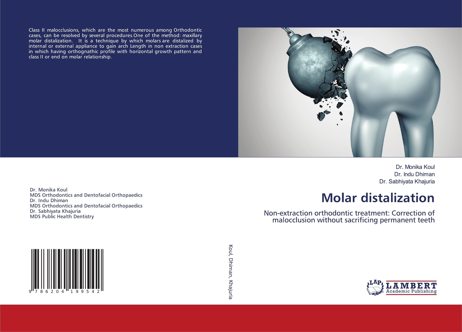 Thumbnail - Monika Koul (u. A.) | Molar Distalization | Taschenbuch | Englisch