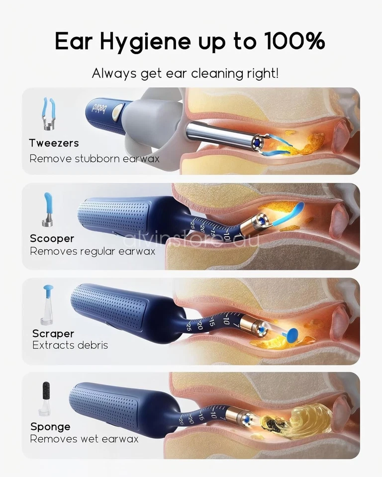 Bebird Ear Wax Removal Tool Earsight Plus Camera Ear Cleaner with Flexible - image 3 of 4
