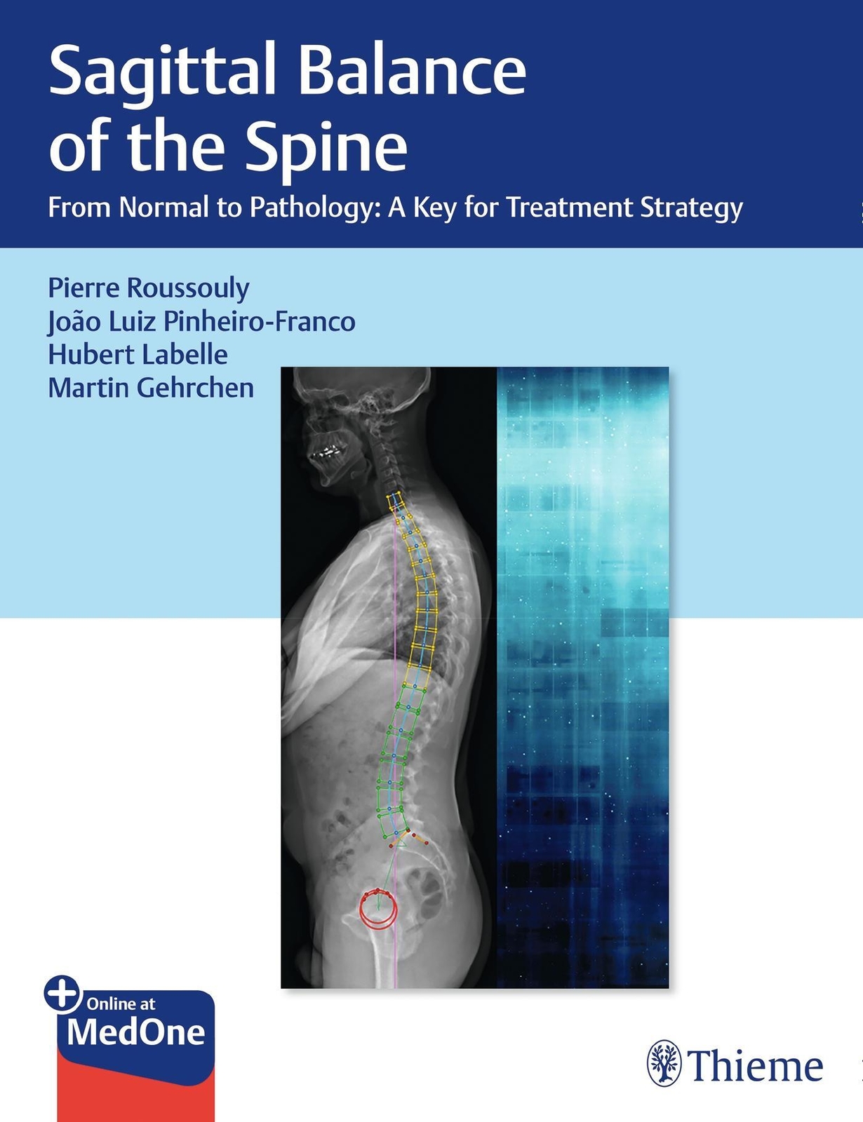 Thumbnail - Sagittal Balance Of The Spine | Pierre Roussouly (u. A.) | Englisch |