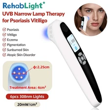 UV Light Therapy for Eczema at Home Ultraviolet Lamp for White Spots on Neck
