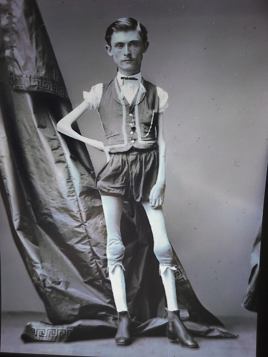 VINTAGE - NEGATIVE - Isaac Sprague - CIRCUS SHOW - HORROR - FREAK