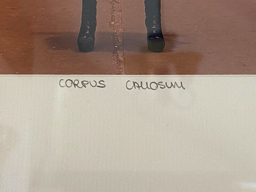 Fotografia d'arte di Hakan Celebi Akif "Corpus Callosum" YellowKorner incorniciata - Foto 4 di 7