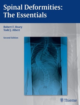 Spinal Deformities: The Essentials
