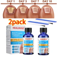 2Pcs Antibacterial Fungal Nail Treatment Nail Repair Essential Oil Nail Care