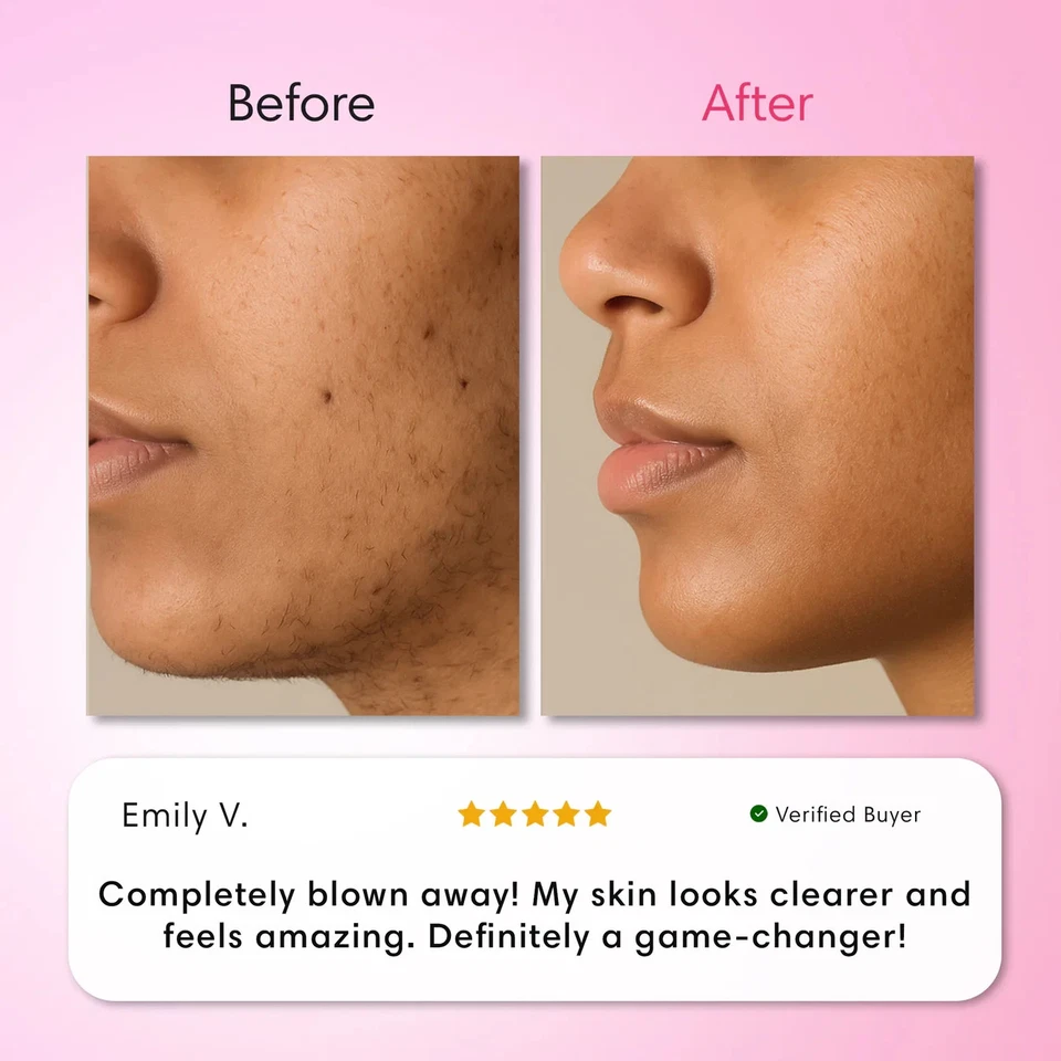 Auures Crema Depilatoria, Kit de Crema Facial, Sin Dolor... Foto 3 de 4