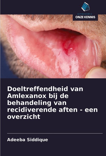 Doeltreffendheid Van Amlexanox Bij De Behandeling Van Recidiverende Aften - Een-image