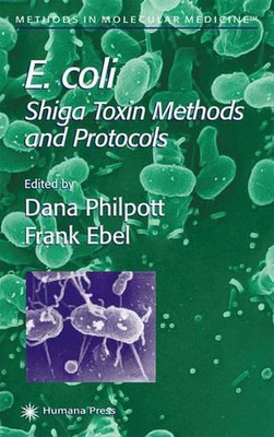 E. coli: Shiga Toxin Methods and Protocols by Dana Philpott (English) Hardcover 