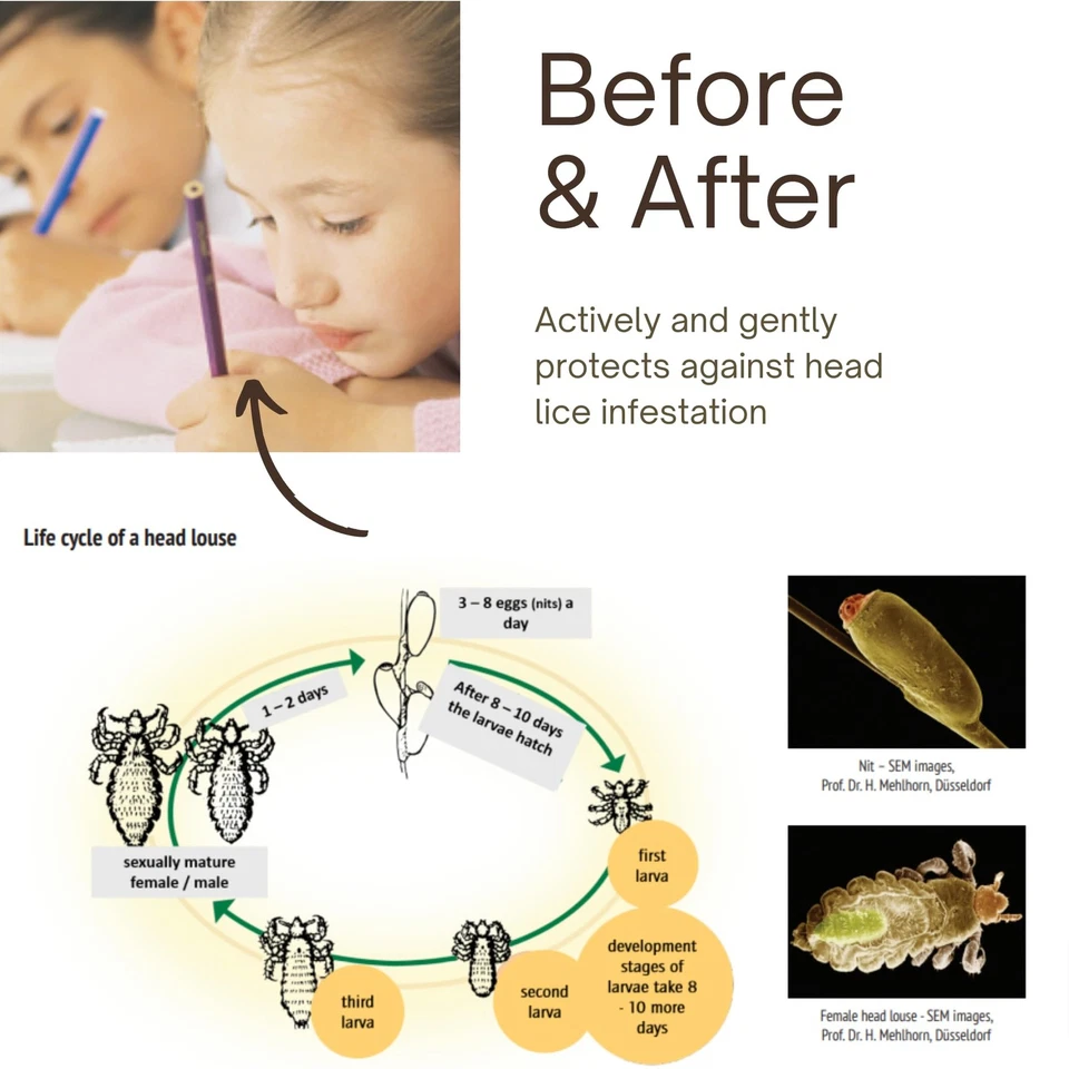 Xampu para tratamento de casca de salgueiro Rausch 200 ml - Imagem 4 de 4