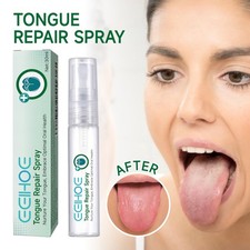 Tongue Repair Spray for Dryness& Bad Breath,Sore Tongue Relief,Oral Care Spray — image 10