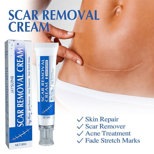 Scar Removal Cream Gel. Anti-Acne Skin Repair Scars Treatment Fade Stretch Mark - Picture 11 of 12