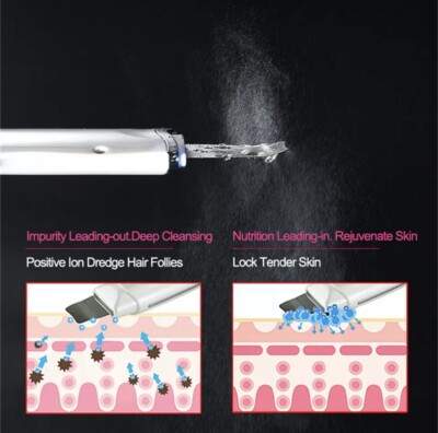 Ultraschall Gesicht Haut Peeling Spatel Tiefenreiniger Peeling Schaufel Peeling UK